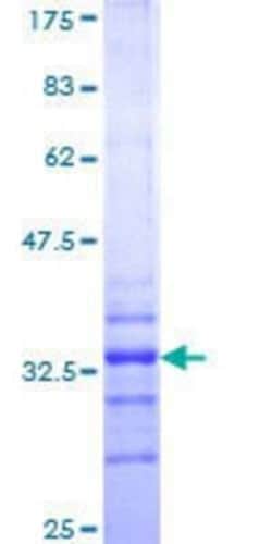 Novus Biologicals Recombinant Human HOXA7 GST (N-Term) Protein 25 &mu;g | Buy Online | Novus Biologicals&trade; | Fisher Scientific