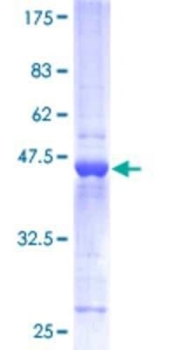 Novus Biologicals Recombinant Human Hippocalcin GST (N-Term) Protein 10 &mu;g | Buy Online | Novus Biologicals&trade; | Fisher Scientific
