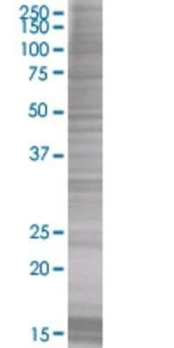 Novus Biologicals Hippocalcin 293T Cell Transient Overexpression Lysate 0.1 mL | Buy Online | Novus Biologicals&trade; | Fisher Scientific