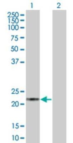 Novus Biologicals Hippocalcin 293T Cell Transient Overexpression Lysate 0.1 mL | Buy Online | Novus Biologicals&trade; | Fisher Scientific