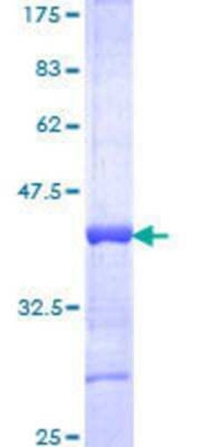 Novus Biologicals Recombinant Human HOXA13 GST (N-Term) Protein 25 &mu;g | Buy Online | Novus Biologicals&trade; | Fisher Scientific