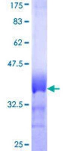 Novus Biologicals Recombinant Human HOXB1 GST (N-Term) Protein 25 &mu;g | Buy Online | Novus Biologicals&trade; | Fisher Scientific