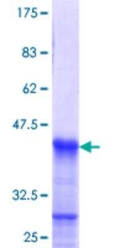 Novus Biologicals Recombinant Human HOXB1 GST (N-Term) Protein 10 &mu;g | Buy Online | Novus Biologicals&trade; | Fisher Scientific