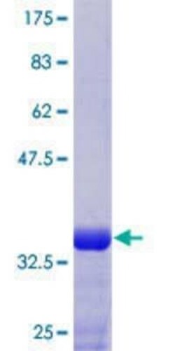 Novus Biologicals Recombinant Human Hoxb3 GST (N-Term) Protein 25 &mu;g | Buy Online | Novus Biologicals&trade; | Fisher Scientific