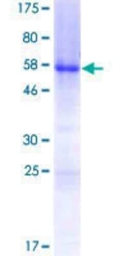 Novus Biologicals Recombinant Human HOXB5 GST (N-Term) Protein 25 &mu;g | Buy Online | Novus Biologicals&trade; | Fisher Scientific