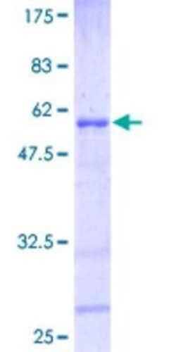 Novus Biologicals Recombinant Human HOXB6 GST (N-Term) Protein 2 &mu;g | Buy Online | Novus Biologicals&trade; | Fisher Scientific