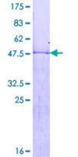 Novus Biologicals Recombinant Human HOXB7 GST (N-Term) Protein 2 &mu;g | Buy Online | Novus Biologicals&trade; | Fisher Scientific