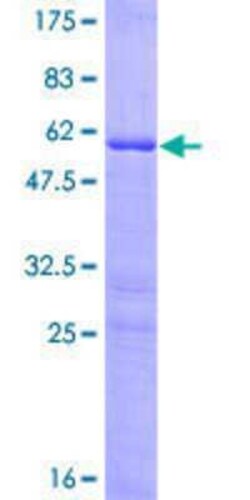 Novus Biologicals Recombinant Human HOXB9 GST (N-Term) Protein 25 &mu;g | Buy Online | Novus Biologicals&trade; | Fisher Scientific