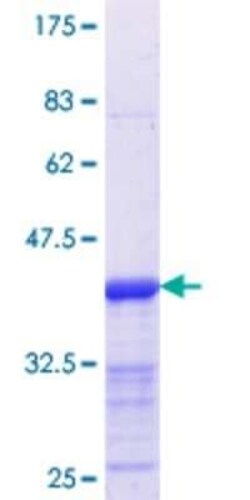 Novus Biologicals Recombinant Human HOXB9 GST (N-Term) Protein 10 &mu;g | Buy Online | Novus Biologicals&trade; | Fisher Scientific