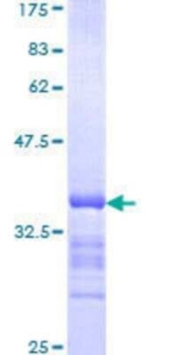 Novus Biologicals Recombinant Human HOXC8 GST (N-Term) Protein 25 &mu;g | Buy Online | Novus Biologicals&trade; | Fisher Scientific