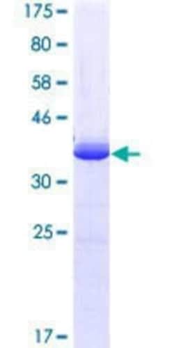 Novus Biologicals Recombinant Human HOXC10 GST (N-Term) Protein 10 &mu;g | Buy Online | Novus Biologicals&trade; | Fisher Scientific