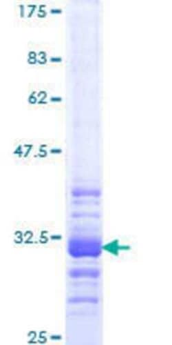 Novus Biologicals Recombinant Human HOXC13 GST (N-Term) Protein 10 &mu;g | Buy Online | Novus Biologicals&trade; | Fisher Scientific