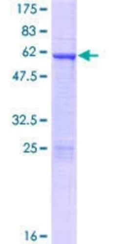 Novus Biologicals Recombinant Human HOXD4 GST (N-Term) Protein 10 &mu;g | Buy Online | Novus Biologicals&trade; | Fisher Scientific