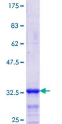 Novus Biologicals Recombinant Human HOXD4 GST (N-Term) Protein 25 &mu;g | Buy Online | Novus Biologicals&trade; | Fisher Scientific
