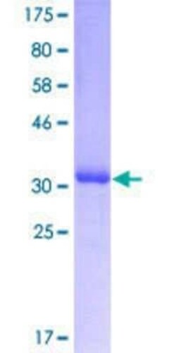 Novus Biologicals Recombinant Human HOXD8 GST (N-Term) Protein 10 &mu;g | Buy Online | Novus Biologicals&trade; | Fisher Scientific