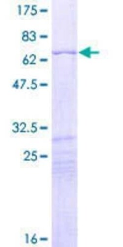 Novus Biologicals Recombinant Human HOXD10 GST (N-Term) Protein 2 &mu;g | Buy Online | Novus Biologicals&trade; | Fisher Scientific
