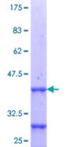 Novus Biologicals Recombinant Human HOXD10 GST (N-Term) Protein 25 &mu;g | Buy Online | Novus Biologicals&trade; | Fisher Scientific