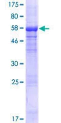 Novus Biologicals Recombinant Human HPS1 GST (N-Term) Protein 25 &mu;g | Buy Online | Novus Biologicals&trade; | Fisher Scientific