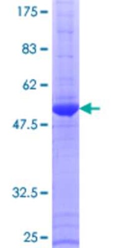 Novus Biologicals Recombinant Human ERAS GST (N-Term) Protein 25 &mu;g | Buy Online | Novus Biologicals&trade; | Fisher Scientific
