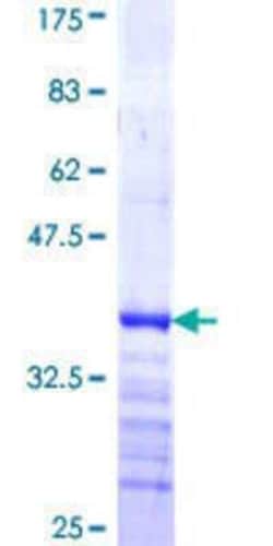 Novus Biologicals Recombinant Human AGFG2 GST (N-Term) Protein 10 &mu;g | Buy Online | Novus Biologicals&trade; | Fisher Scientific