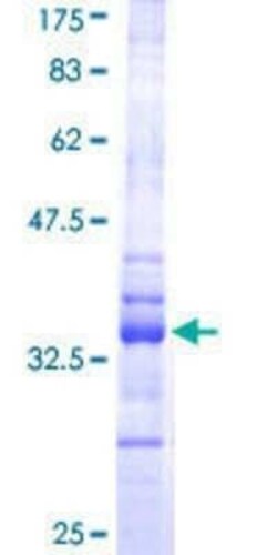 Novus Biologicals&trade;&nbsp;Recombinant Human HES-1 GST (N-Term) Protein