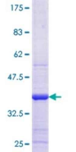 Novus Biologicals Recombinant Human Beta Hydroxysteroid Dehydrogenase GST (N-Term) Protein 10 &mu;g | Buy Online | Novus Biologicals&trade; | Fisher Scientific