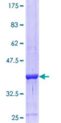 Novus Biologicals Recombinant Human HSD11B2 GST (N-Term) Protein 25 &mu;g | Buy Online | Novus Biologicals&trade; | Fisher Scientific
