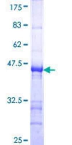 Novus Biologicals Recombinant Human HSD17B2 GST (N-Term) Protein 10 &mu;g | Buy Online | Novus Biologicals&trade; | Fisher Scientific