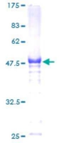 Novus Biologicals Recombinant Human HSF2 GST (N-Term) Protein 2 &mu;g | Buy Online | Novus Biologicals&trade; | Fisher Scientific