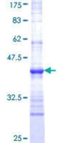 Novus Biologicals Recombinant Human HSF4 GST (N-Term) Protein 25 &mu;g | Buy Online | Novus Biologicals&trade; | Fisher Scientific