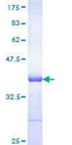 Novus Biologicals Recombinant Human HspA1B GST (N-Term) Protein 10 &mu;g | Buy Online | Novus Biologicals&trade; | Fisher Scientific