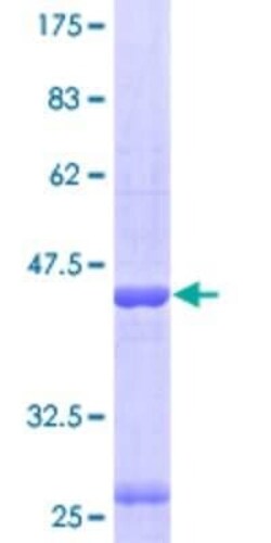 Novus Biologicals Recombinant Human HspA4 GST (N-Term) Protein 10 &mu;g | Buy Online | Novus Biologicals&trade; | Fisher Scientific