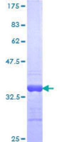 Novus Biologicals Recombinant Human 5-HT1A GST (N-Term) Protein 25 &mu;g | Buy Online | Novus Biologicals&trade; | Fisher Scientific