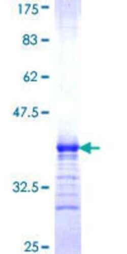 Novus Biologicals Recombinant Human 5-HT1B GST (N-Term) Protein 25 &mu;g | Buy Online | Novus Biologicals&trade; | Fisher Scientific
