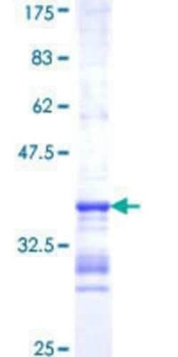 Novus Biologicals Recombinant Human 5-HT1F GST (N-Term) Protein 10 &mu;g | Buy Online | Novus Biologicals&trade; | Fisher Scientific