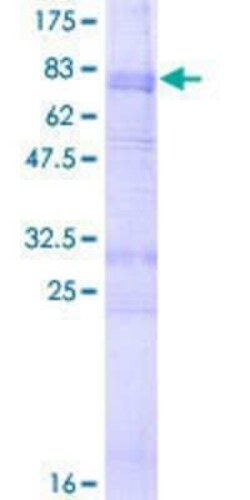 Novus Biologicals Recombinant Human 5-HT2B GST (N-Term) Protein 2 &mu;g | Buy Online | Novus Biologicals&trade; | Fisher Scientific