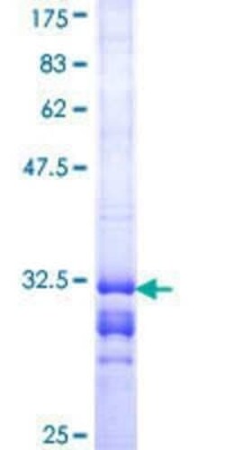 Novus Biologicals Recombinant Human 5-HT2B GST (N-Term) Protein 25 &mu;g | Buy Online | Novus Biologicals&trade; | Fisher Scientific