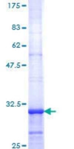 Novus Biologicals Recombinant Human 5-HT2C GST (N-Term) Protein 25 &mu;g | Buy Online | Novus Biologicals&trade; | Fisher Scientific