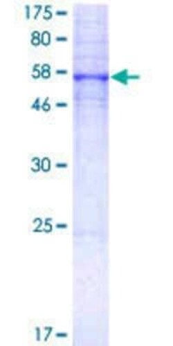Novus Biologicals Recombinant Human 5-HT5A GST (N-Term) Protein 2 &mu;g | Buy Online | Novus Biologicals&trade; | Fisher Scientific