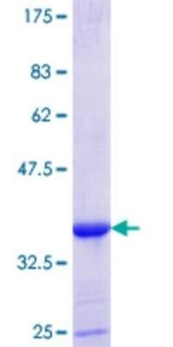 Novus Biologicals Recombinant Human Isoleucyl tRNA synthetase GST (N-Term) Protein 25 &mu;g | Buy Online | Novus Biologicals&trade; | Fisher Scientific
