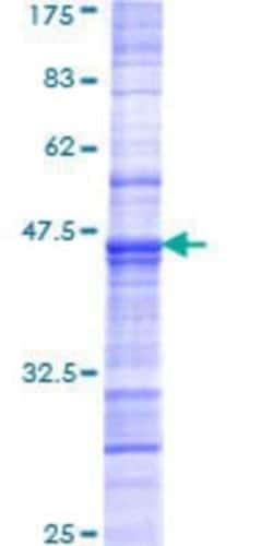 Novus Biologicals Recombinant Human IRF8 GST (N-Term) Protein 25 &mu;g | Buy Online | Novus Biologicals&trade; | Fisher Scientific