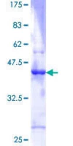 Novus Biologicals Recombinant Human ID3 GST (N-Term) Protein 10 &mu;g | Buy Online | Novus Biologicals&trade; | Fisher Scientific