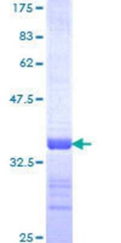 Novus Biologicals Recombinant Human ID3 GST (N-Term) Protein 25 &mu;g | Buy Online | Novus Biologicals&trade; | Fisher Scientific