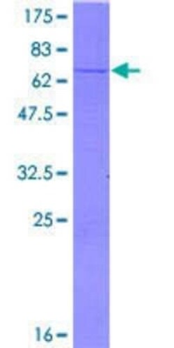 Novus Biologicals Recombinant Human IDH3B GST (N-Term) Protein 2 &mu;g | Buy Online | Novus Biologicals&trade; | Fisher Scientific