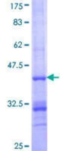 Novus Biologicals Recombinant Human IDH3B GST (N-Term) Protein 10 &mu;g | Buy Online | Novus Biologicals&trade; | Fisher Scientific