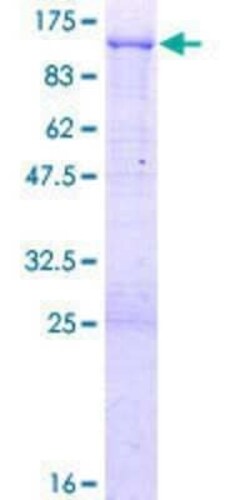Novus Biologicals Recombinant Human IFI16 GST (N-Term) Protein 2 &mu;g | Buy Online | Novus Biologicals&trade; | Fisher Scientific