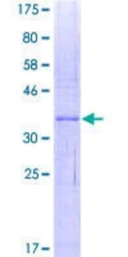 Novus Biologicals Recombinant Human IFI27 GST (N-Term) Protein 10 &mu;g | Buy Online | Novus Biologicals&trade; | Fisher Scientific