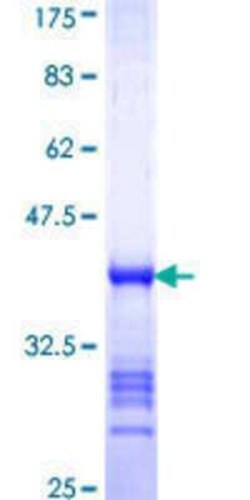 Novus Biologicals Recombinant Human IFI35 GST (N-Term) Protein 25 &mu;g | Buy Online | Novus Biologicals&trade; | Fisher Scientific