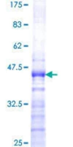 Novus Biologicals Recombinant Human SP110 GST (N-Term) Protein 25 &mu;g | Buy Online | Novus Biologicals&trade; | Fisher Scientific