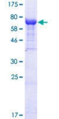 Novus Biologicals Recombinant Human IFIT2 GST (N-Term) Protein 25 &mu;g | Buy Online | Novus Biologicals&trade; | Fisher Scientific